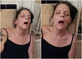 Heroin turns you into a zombie